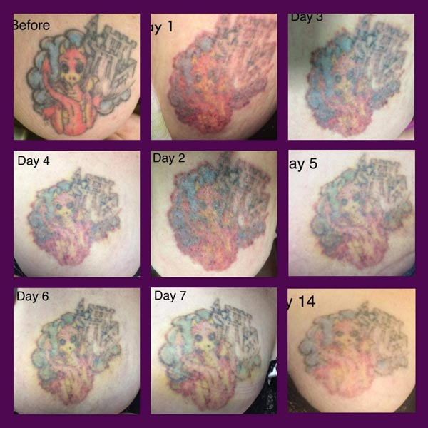 Tattoo Progress